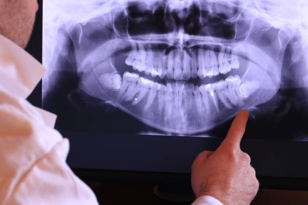 Best Dental Abscess Treatment in Lorena, TX
