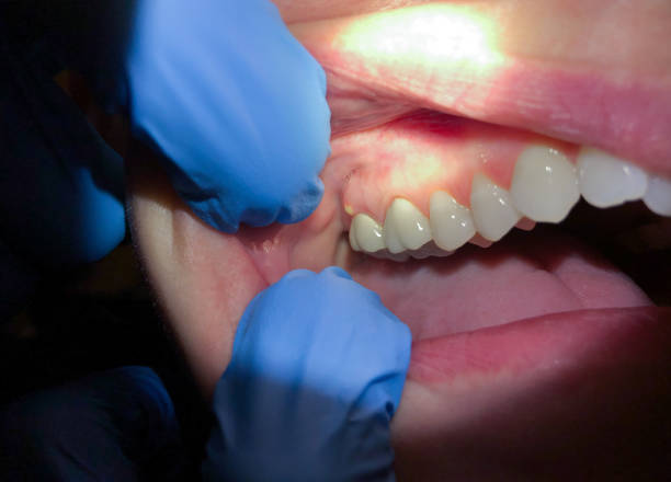 Best Walk-In Emergency Dental Services in Lorena, TX